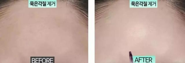 张韶涵推荐去角质视频,张韶涵出绝招