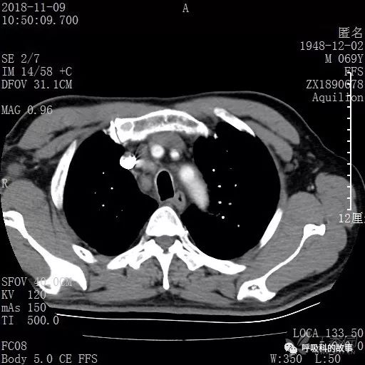 怎么应用统计学做调查,统计学方法可以解决的主要问题