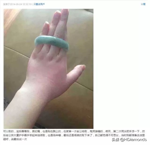 玉镯取不下来怎么办,玉镯卡在手上紧紧的怎么取出来