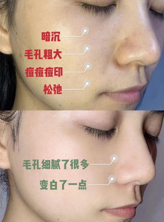 陈乔恩金箔面膜,陈乔恩皮肤真好