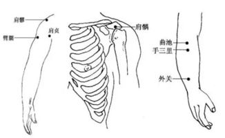 肘关节疼一招搞定中药,肘关节痛针灸哪些穴位