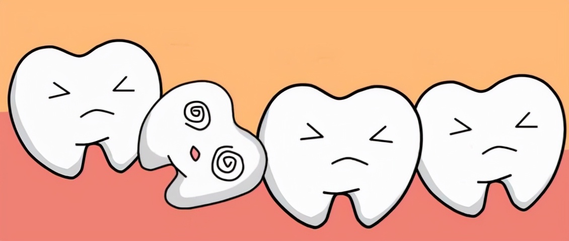 牙齿拥挤会导致缺牙吗,牙齿拥挤对脸型的影响