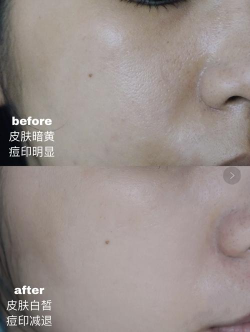 韩束面膜美白淡化色斑,韩束发光面膜