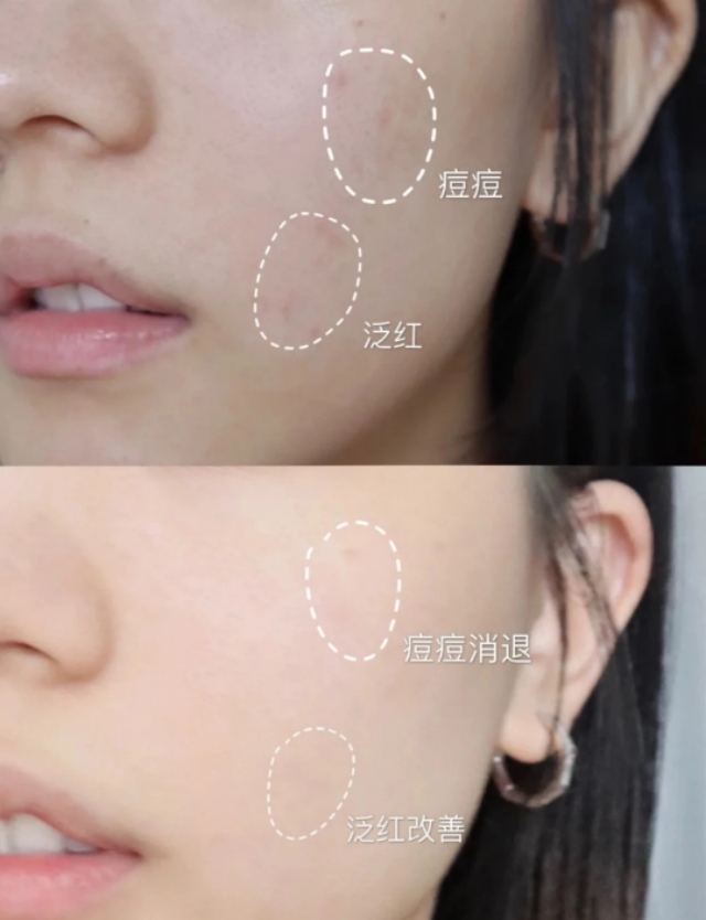 科颜氏金盏花面霜推荐买么,科颜氏金盏花保湿面霜