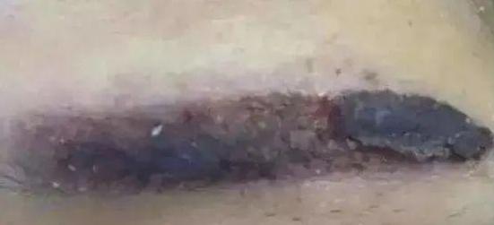 纹眉内幕揭秘,揭秘纹眉内幕