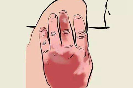 痛风高尿酸运动,痛风跑步尿酸会升高吗