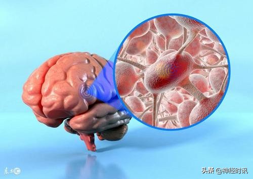 恶性胶质瘤的研究进展,胶质瘤免疫治疗的热点话题