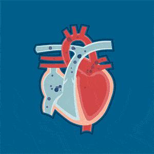 甲亢案例,甲亢治愈后眼球突自救方法