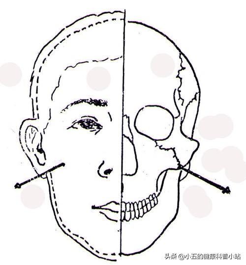 过敏性鼻炎针刺哪些穴位有效,针刺蝶腭神经节治鼻炎