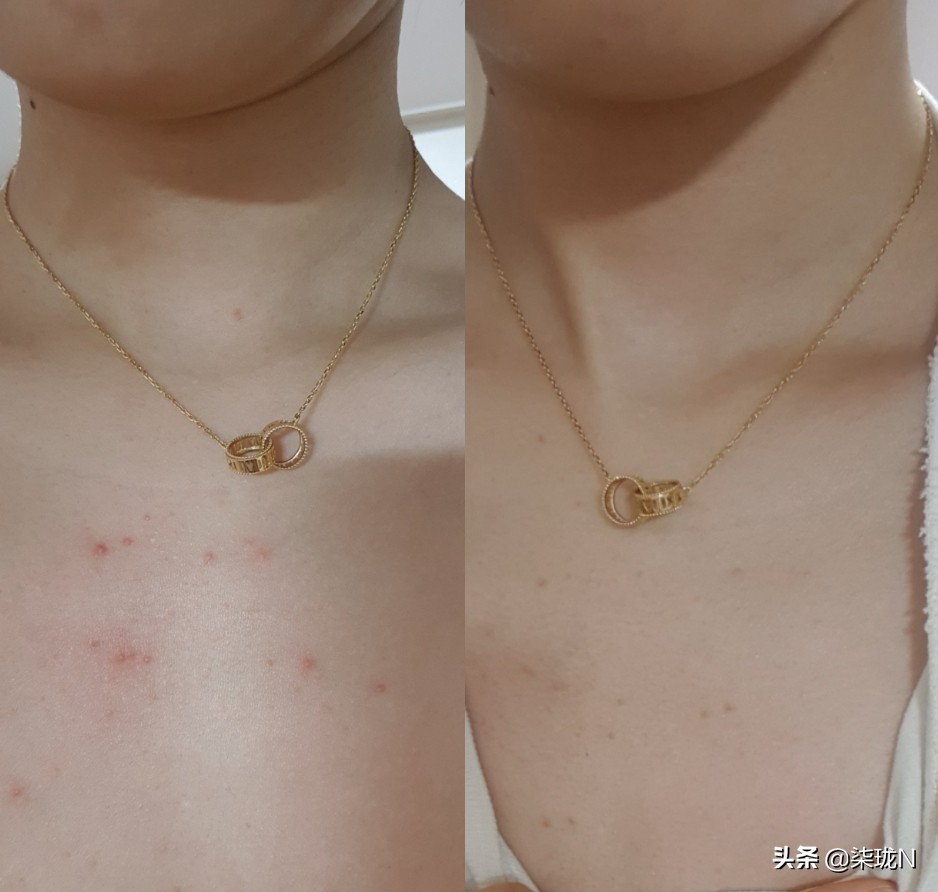 韩国小姐姐对伊安秀Iancell-L产品使用后期真实回馈