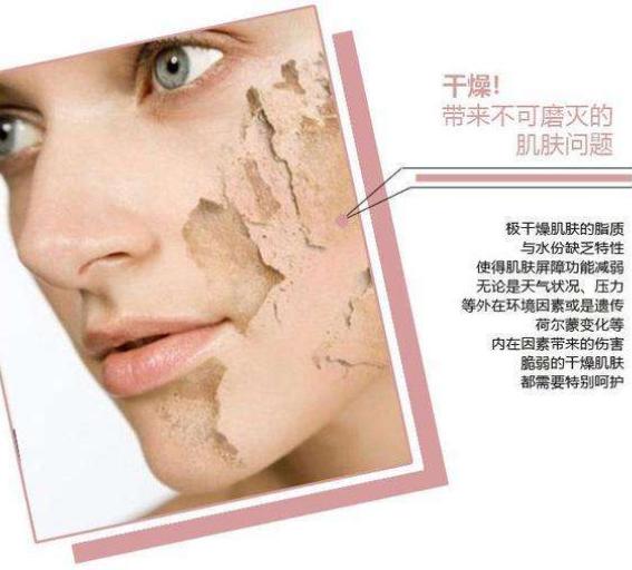 皮肤特别干燥有皱纹咋办,皮肤干燥有细纹的女人吃什么护肤