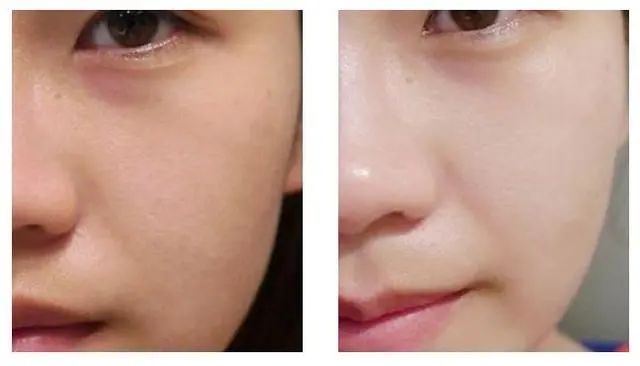 婴儿肌是怎么保养的,婴儿睡觉是身体在自我修复吗