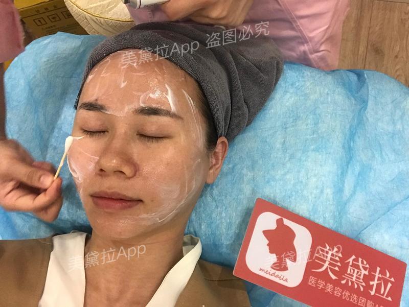 类人胶原蛋白能收缩毛孔么,胶原蛋白抗皱原液真实测评