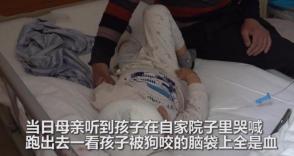 孩子被狗咬父母应该怎么办,孩子被狗咬如何自救