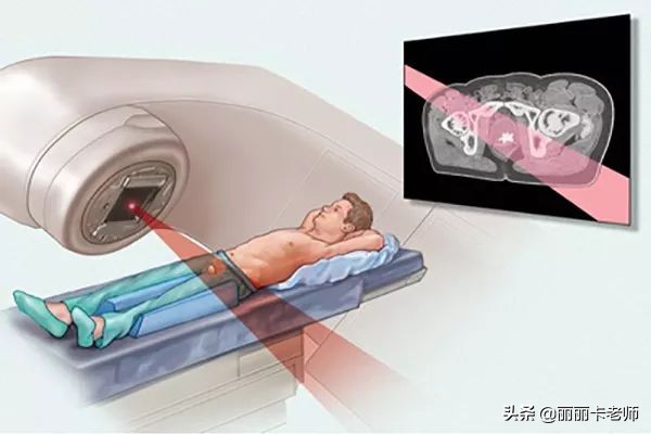 癌症最长寿的三种方法,科普癌症治疗的三种主要方法