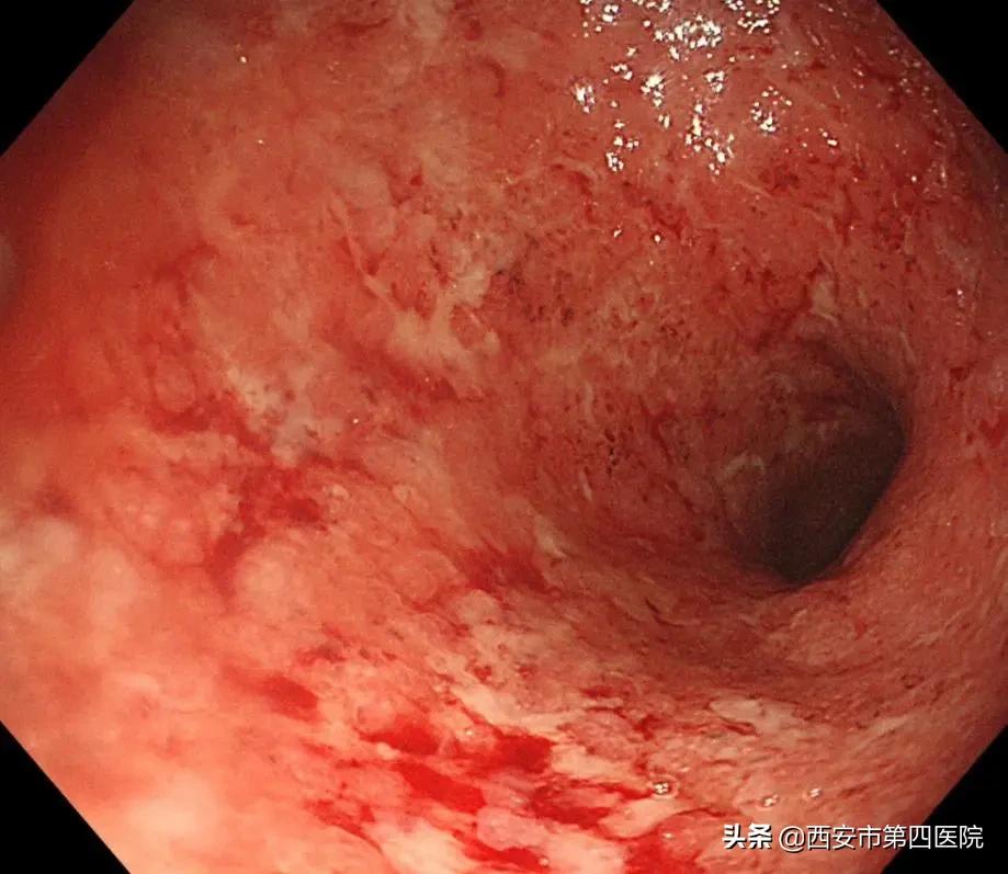 健康中国2023重大行动,健康中国行动是真是假