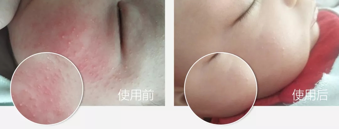 蔡依林的腿值多少钱,蔡依林最迷人的鞋