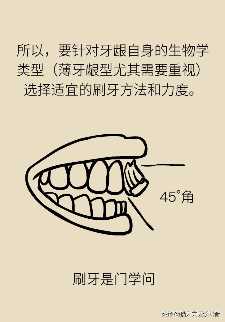 牙根露出来怎样修复不动刀,牙根暴露但没疼痛感怎么办