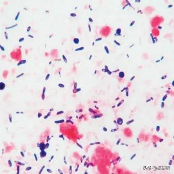 显微镜下的猫屎，竟然和这么多食物都撞脸？