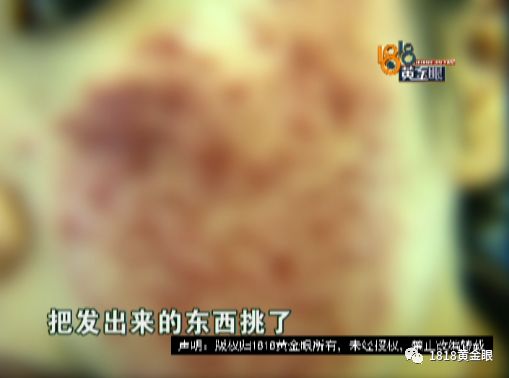 为了变美打整形针,为了美打除皱脸肿图片