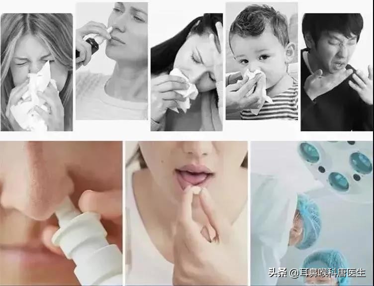 为什么一换季鼻炎就发作,换季鼻炎就发作吃什么药