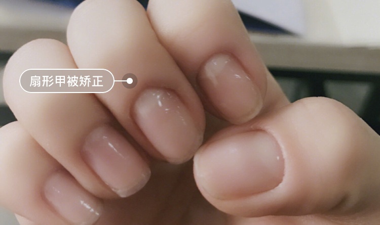 易劈易断还分层？美国专业沙龙修复甲油，给“病甲”快速“整容”