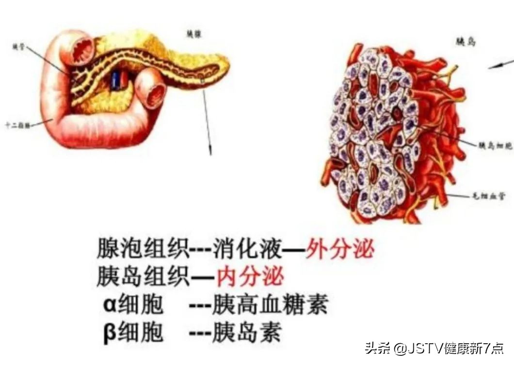 糖尿病人血糖多高怀疑是胰腺癌,胰腺癌患者有糖尿病血糖会更高吗