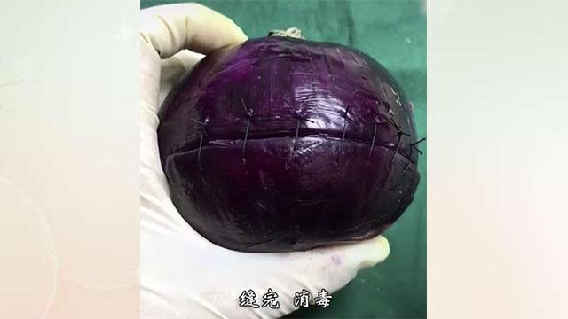 产科医生剖腹产真实流程,妇产科医生剖腹产片段