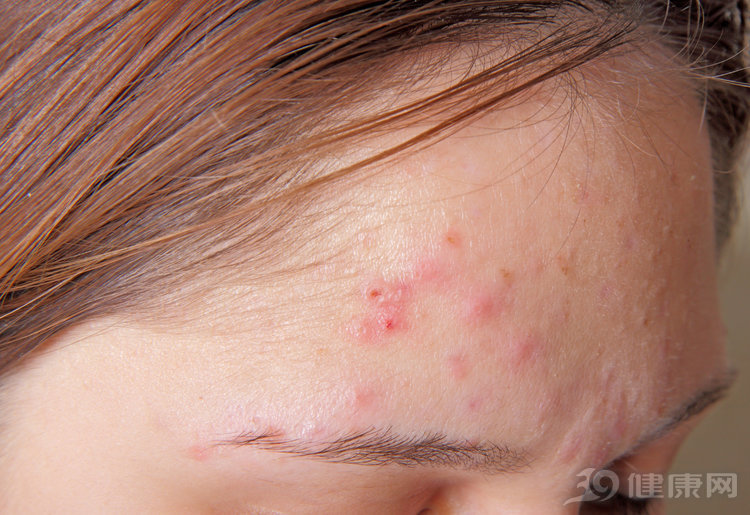 调理女人内分泌,调理女性内分泌的方法是什么