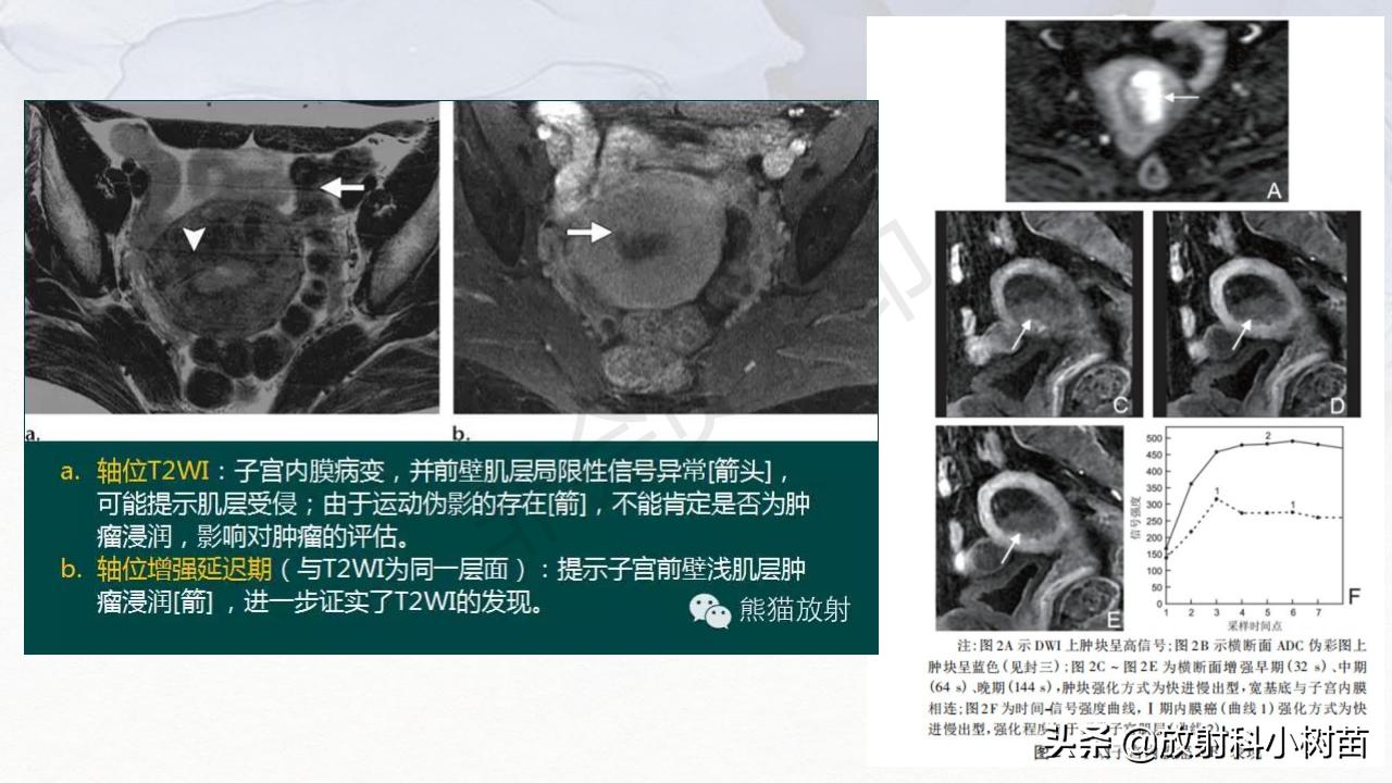 女性盆腔mri解剖图谱,泌尿生殖系统x线解剖