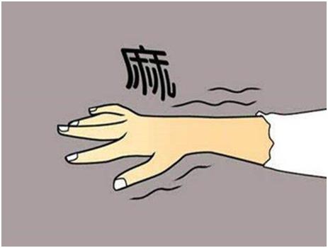 小中风症状有哪些,小中风前兆的十个表现