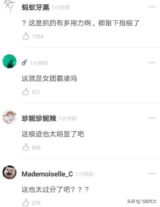 九阴白骨爪？宇宙少女挠出血！韩国女团成员狠挠队友恩熙为哪般？