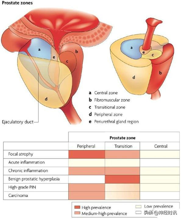 肾脏输尿管膀胱前列腺结构,肾输尿管膀胱解剖示意图