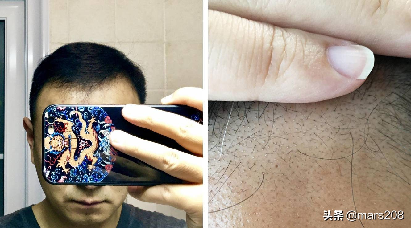 保护发际线的洗发水测评,保护发际线洗发水测评