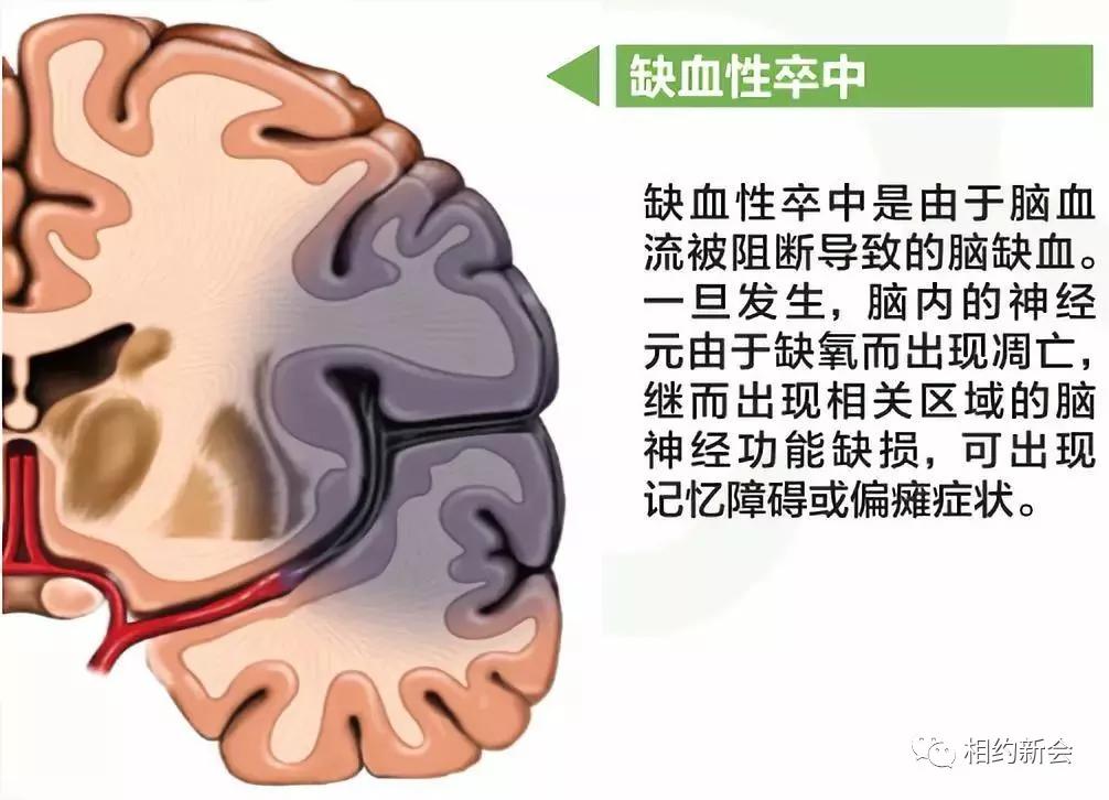 温县人民医院卒中中心,温县第二人民医院视频