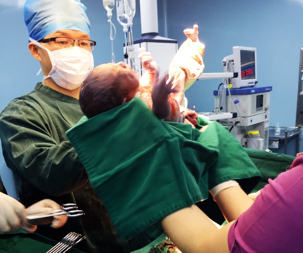 产科医生剖腹产真实流程,妇产科医生剖腹产片段