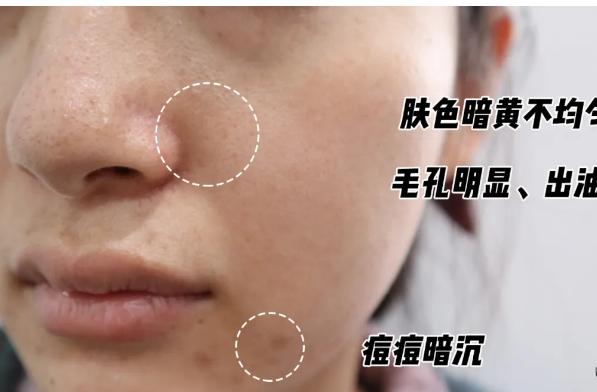 30多岁抗初老水乳套装,抗初老水乳推荐第一名