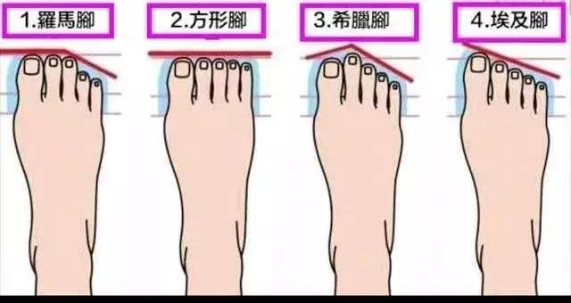 罗马脚埃及脚希腊脚的区别,希腊脚埃及脚罗马脚各的优缺点
