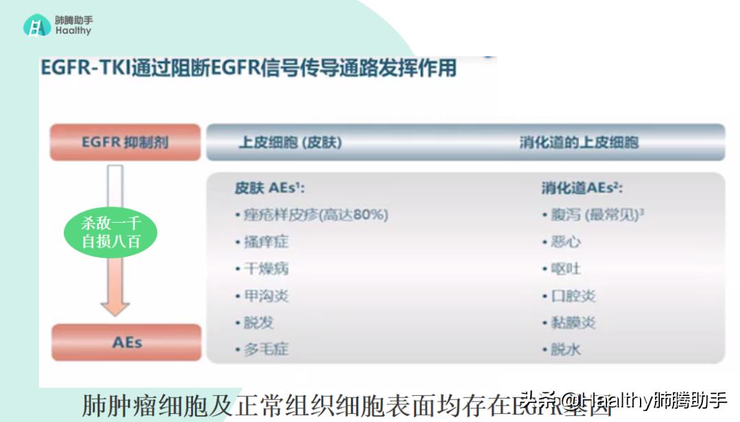 专家谈中医治疗肺癌方法,肺癌晚期放疗有什么副作用和危害