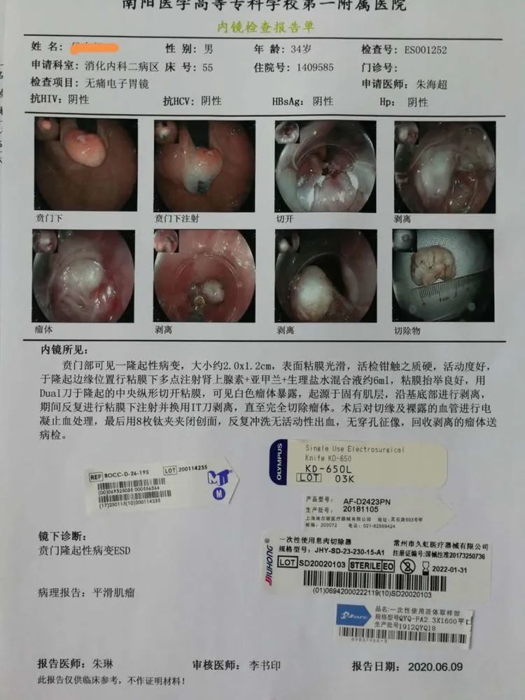 贲门隆起性病变影像,贲门溃疡隆起性病变