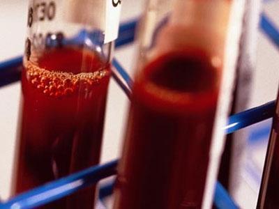 过敏性紫癜儿童的治疗方法及用药,儿童过敏性紫癜复查需要复查血吗