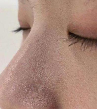 毛孔粗大有黑头适合什么粉底液,遮盖粗大毛孔黑头用什么粉底液