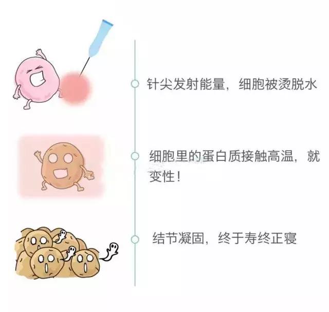 甲状腺结节频发，该拿它怎么办才好？