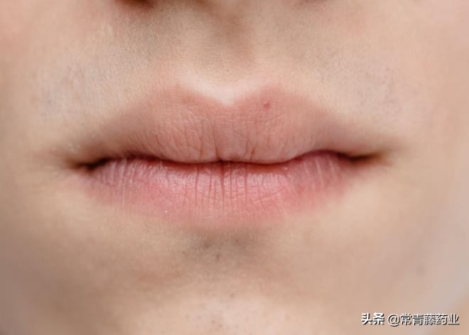 嘴唇反反复复的痒脱皮什么原因,嘴唇脱皮痒是什么原因引起的