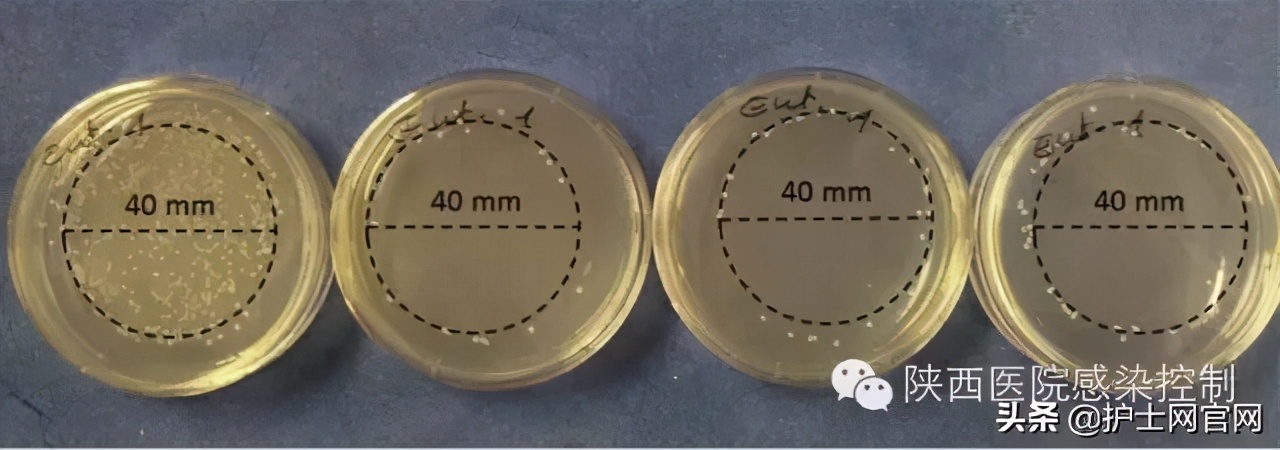 护士长，你们科室的听诊器膜消毒了吗？