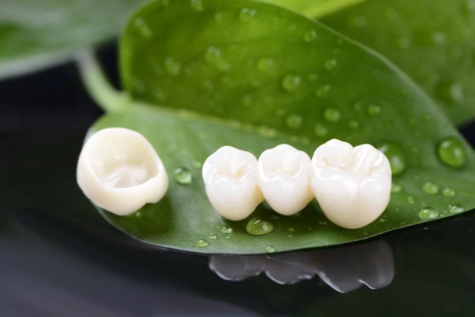 全瓷牙和烤瓷牙对牙龈的影响,烤瓷牙牙龈炎能根治吗