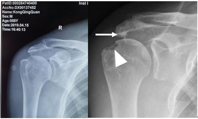 罗吉伟,罗吉伟教授