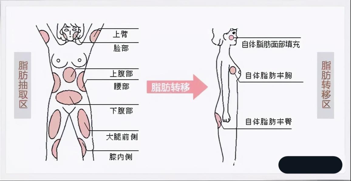 医美踩过的坑自述,医美经验100个坑