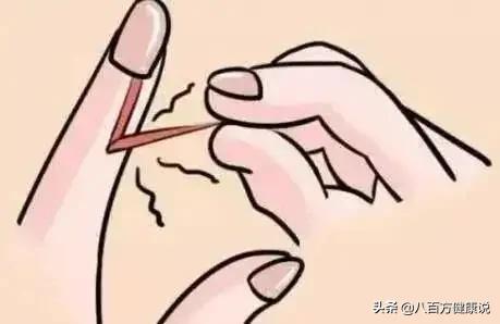 几块钱一支的国民灵药“红霉素软膏”，功效居然这么多