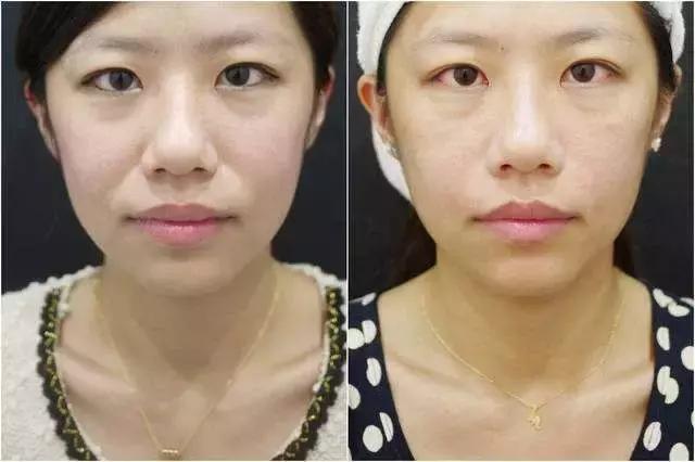 什么脸老了最容易显老,脸上有这5个特征的女人